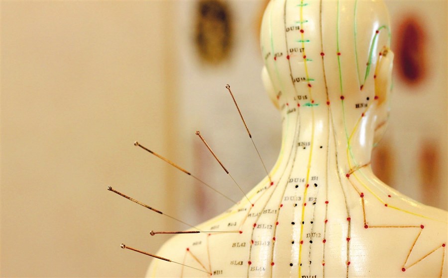 Как работает иглоукалывание?